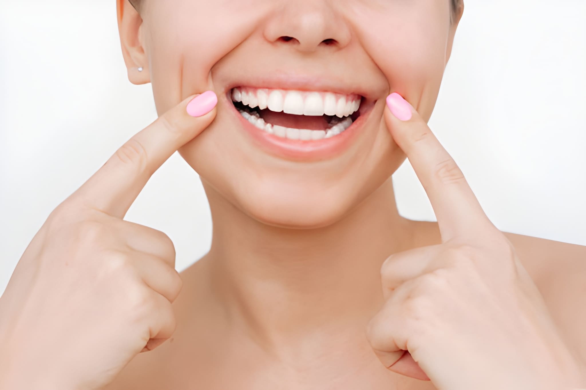 Hollywood Smile
